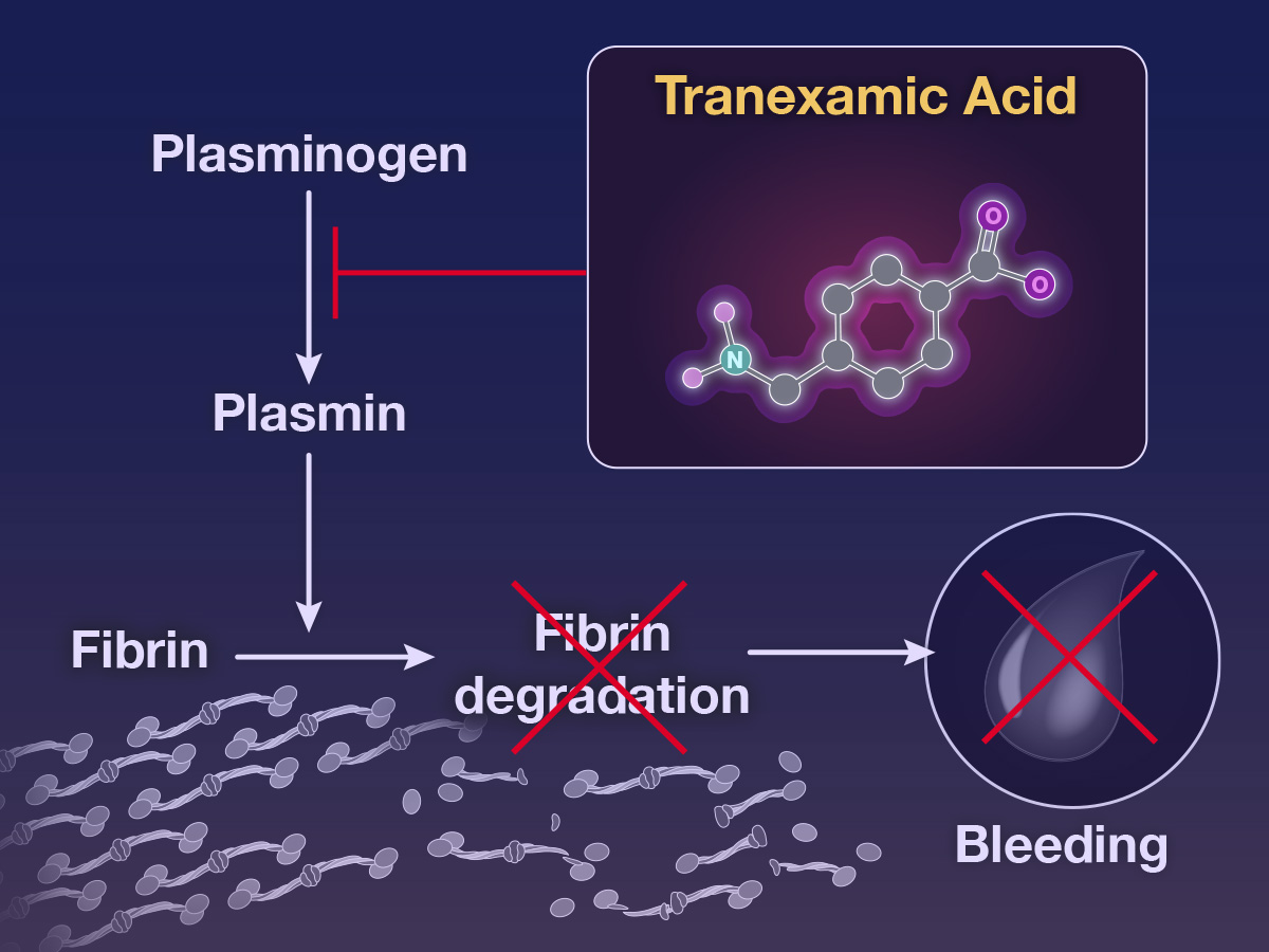 Ac Tranexamique et trauma sévères