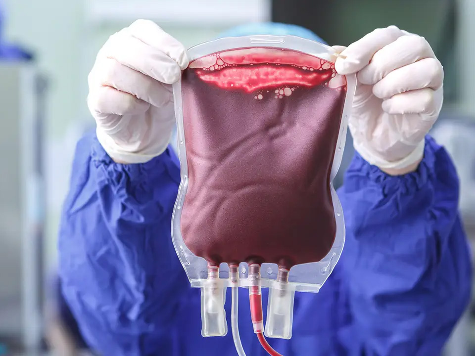Transfusion libérale vs restrictive post TC
